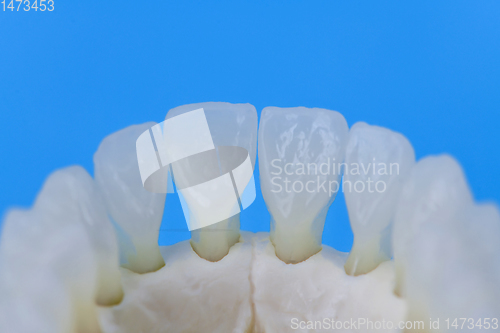 Image of Lower human jaw with teeth anatomy model