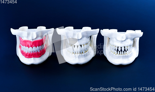 Image of Human jaws with teeth and gums anatomy models