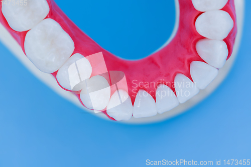 Image of Lower human jaw with teeth and gums anatomy model