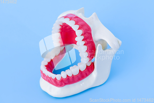 Image of Dentist orthodontic teeth model