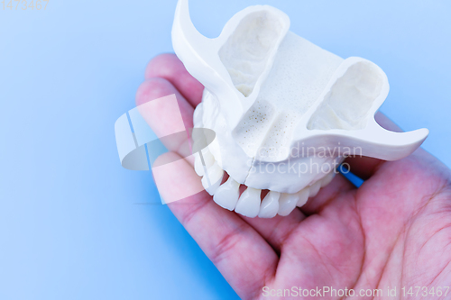 Image of Human hand holding a upper jaw with teeth
