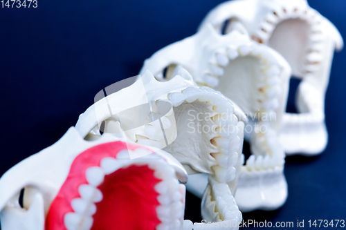 Image of Dentist orthodontic teeth models