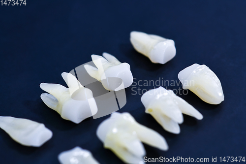 Image of White teeth on blue background