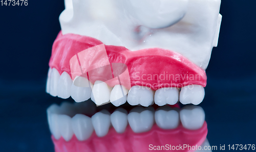 Image of Upper human jaw model with a reflection on the glass