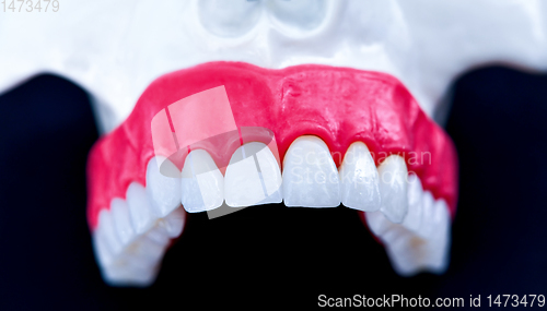 Image of Upper human jaw with teeth and gums anatomy model