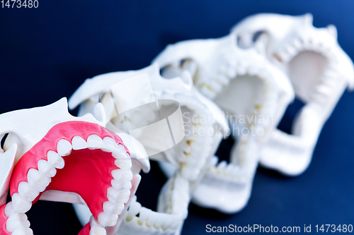 Image of Dentist orthodontic teeth models