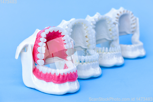 Image of Dentist orthodontic teeth models