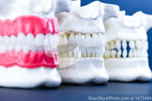 Image of Human jaws with teeth and gums anatomy models