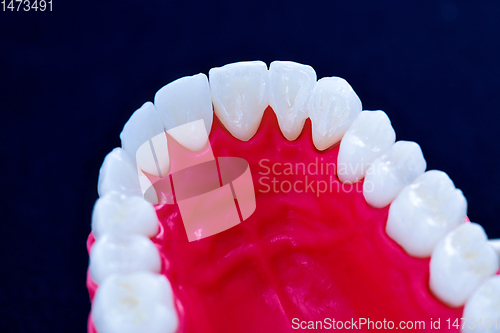 Image of Upper human jaw with teeth and gums anatomy model