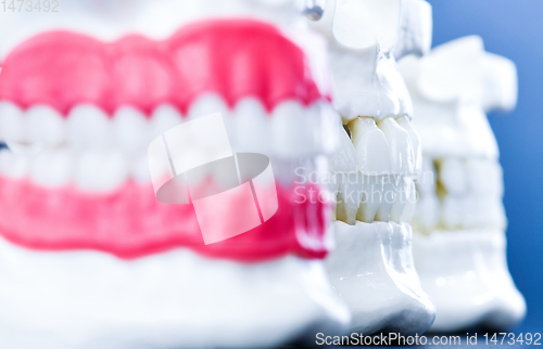 Image of Human jaws with teeth and gums anatomy models