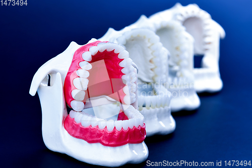 Image of Dentist orthodontic teeth models