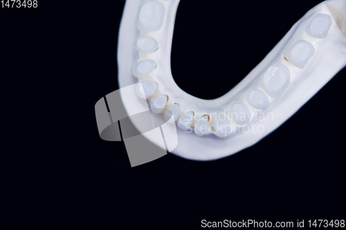 Image of Lower human jaw with teeth isolated on black background
