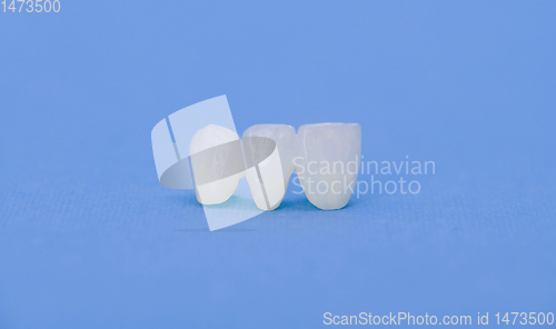 Image of Metal free ceramic dental crowns