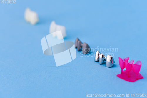 Image of different types of dental tooth crowns