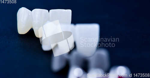 Image of different types of dental tooth crowns