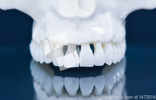 Image of Upper human jaw model with a reflection on the glass