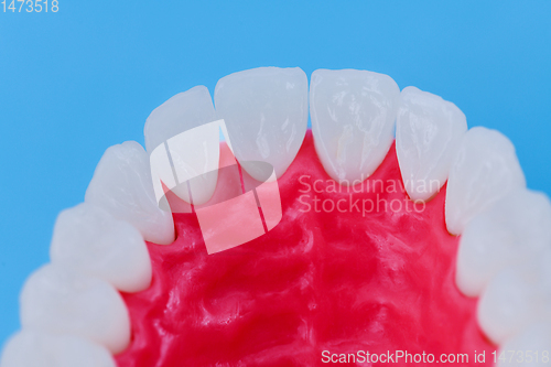 Image of Upper human jaw with teeth and gums anatomy model