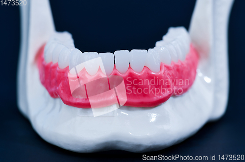 Image of Lower human jaw with teeth and gums anatomy model