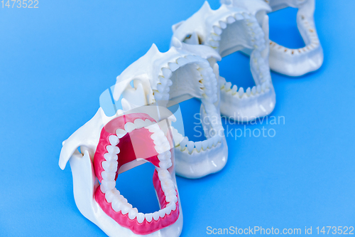 Image of Dentist orthodontic teeth models