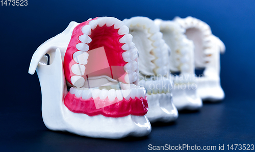 Image of Dentist orthodontic teeth models