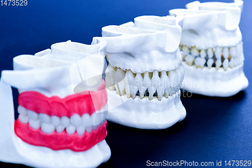 Image of Human jaws with teeth and gums anatomy models