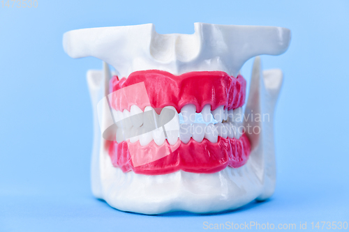 Image of Human jaw with teeth and gums anatomy model