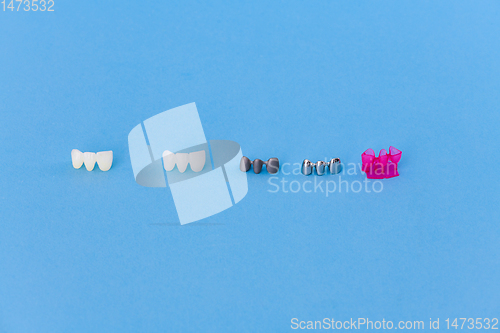 Image of different types of dental tooth crowns