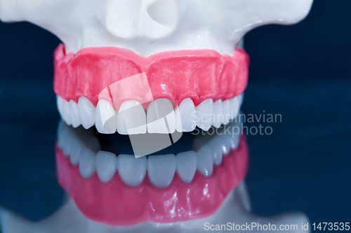 Image of Upper human jaw model with a reflection on the glass