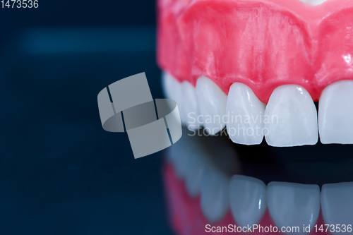 Image of Upper human jaw model with a reflection on the glass