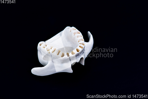 Image of Upper human jaw with teeth isolated on black background