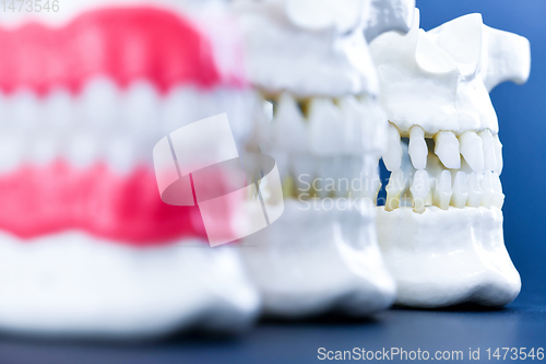 Image of Human jaws with teeth and gums anatomy models