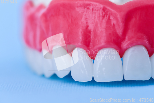 Image of Upper human jaw with teeth and gums anatomy model