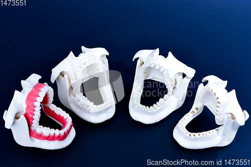 Image of Dentist orthodontic teeth models