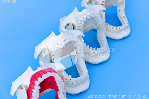 Image of Dentist orthodontic teeth models