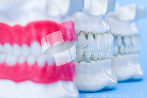 Image of Human jaws with teeth and gums anatomy models