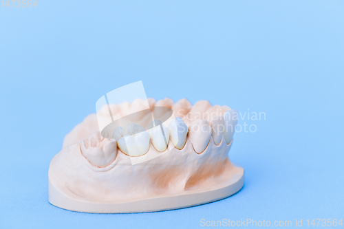 Image of Gypsum model of human jaw