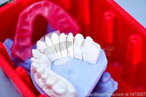 Image of Gypsum model of human jaw