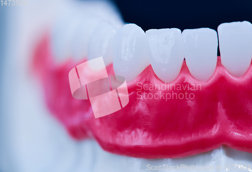 Image of Lower human jaw with teeth and gums anatomy model