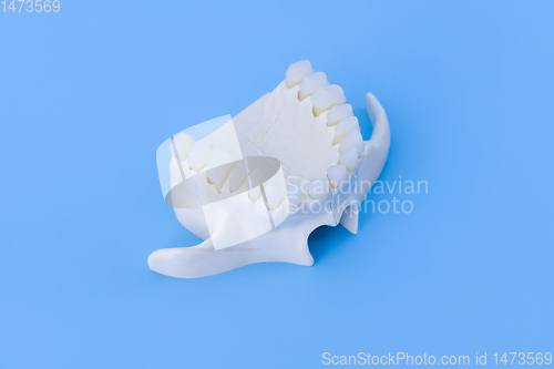 Image of Upper human jaw with teeth