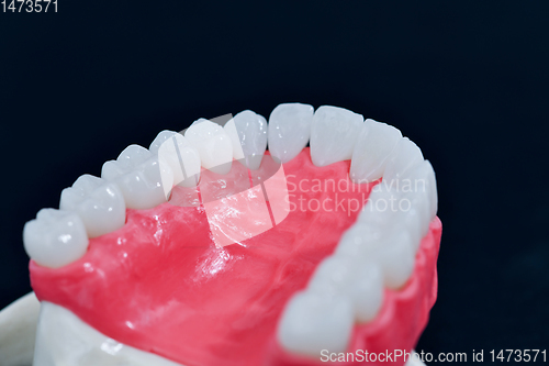 Image of Upper human jaw with teeth and gums anatomy model