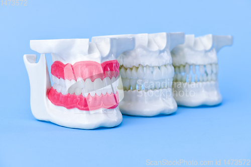 Image of Human jaws with teeth and gums anatomy models