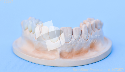 Image of Gypsum model of human jaw