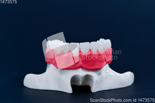 Image of Upper human jaw with teeth and gums anatomy model