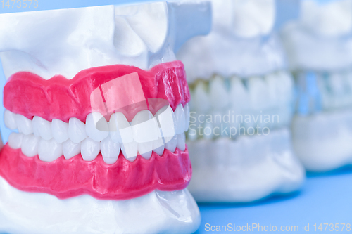 Image of Human jaws with teeth and gums anatomy models