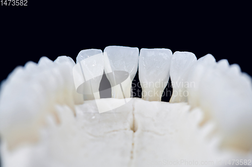 Image of Lower human jaw with teeth isolated on black background