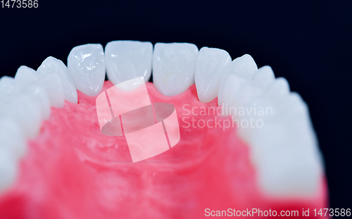 Image of Upper human jaw with teeth and gums anatomy model