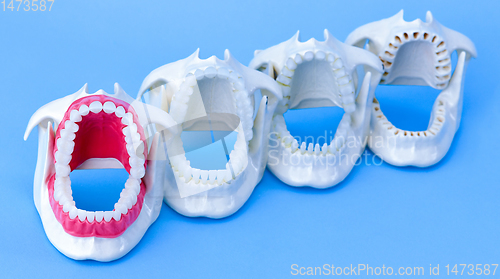 Image of Dentist orthodontic teeth models