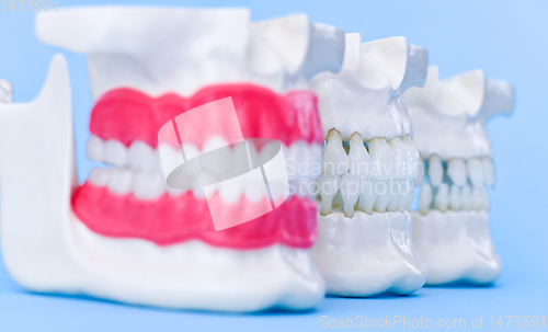 Image of Human jaws with teeth and gums anatomy models