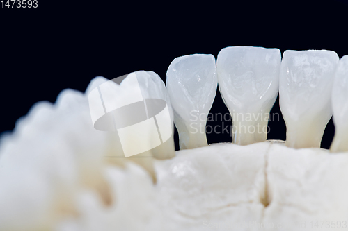 Image of Lower human jaw with teeth isolated on black background