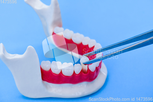 Image of tweezers pulling tooth from the lower jaw model